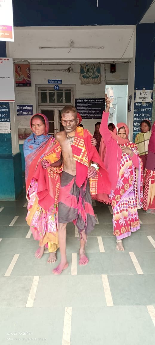युवक ने  खुद  को आग के हवाले किया, आग लगाने का कारण अज्ञात 