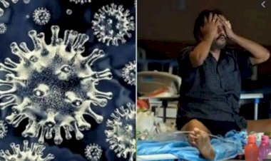 कोरोना पूरी तरह गया नहीं और एक नई मुसीबत के रूप में Black Fungus लक्षणों के प्रकरणों ने सरकार की चिंता बढ़ा दी 